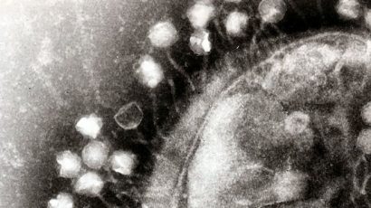 A transmission electron micrograph of multiple bacteriophages attached to a bacterial cell wall, shown at a magnification of approximately 200,000. Photo credit: Graham Beards