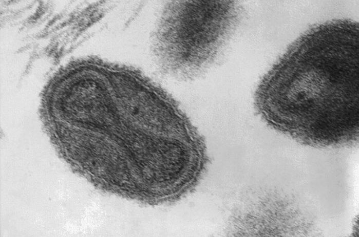Smallpox virus virions. Credit: Fred Murphy / Sylvia Whitfield / CDC.