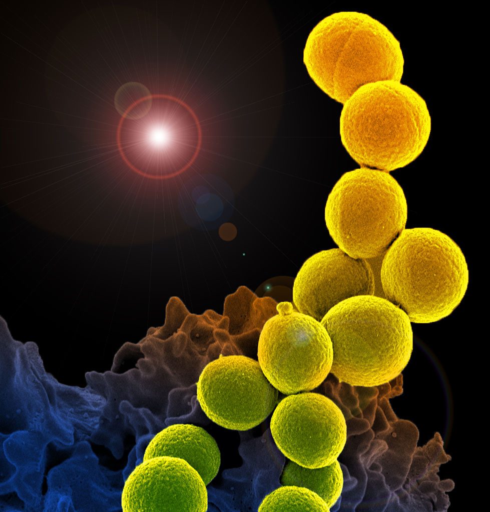 A colorized scanning electron micrograph of a white blood cell eating an antibiotic resistant strain of Staphylococcus aureus bacteria, commonly known as MRSA. Source: National Institute of Allergy and Infectious Diseases (NIAID)
