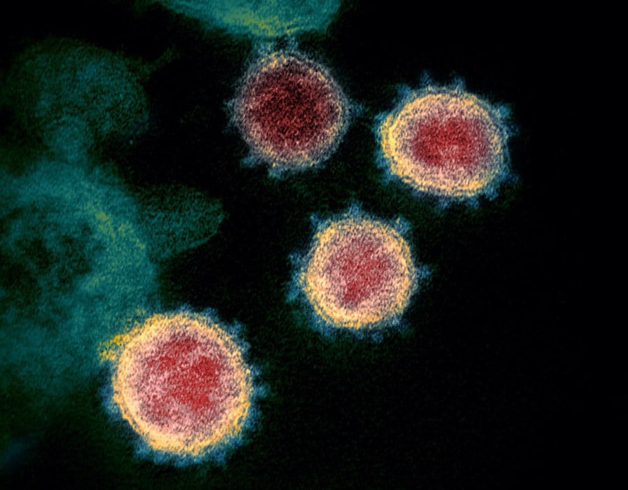 closeup of coronavirus through microscope