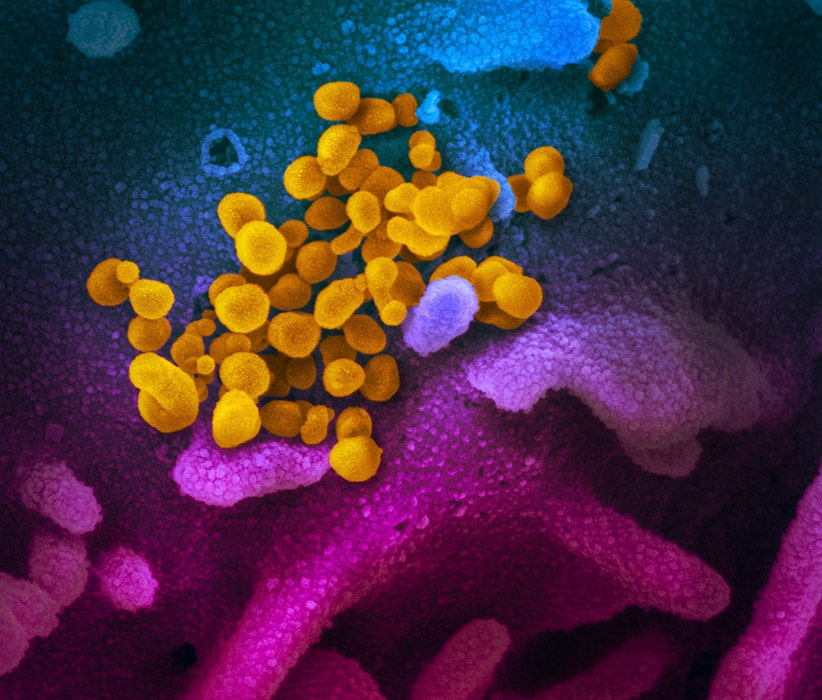 coronavirus as seen through scanning electron microscope
