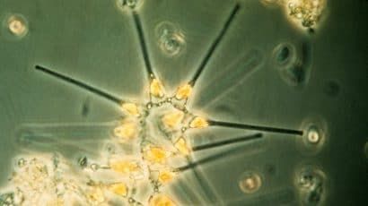 An photograph of microscopic ocean plants, or phytoplankton