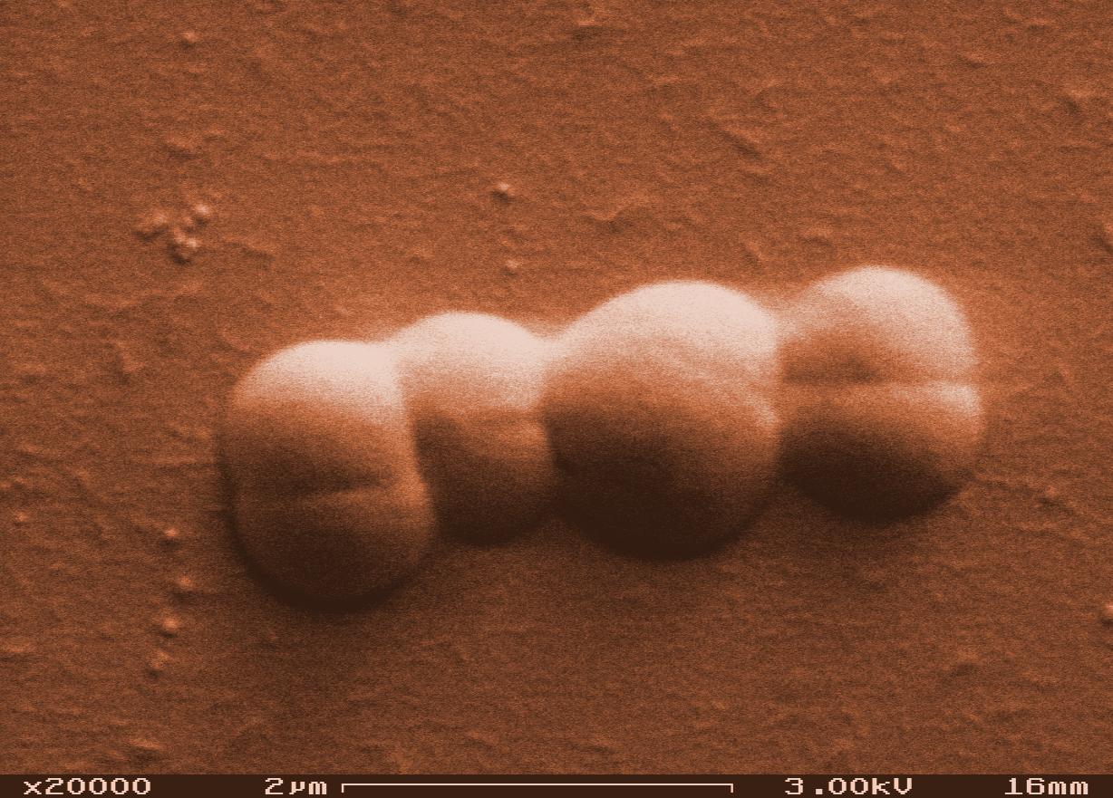 <em>Deinococcus radiodurans</em> is a bacterium that can survive thousands of times more radiation exposure than a human. Microbiologists have demonstrated the astonishing survival of microbes in places no one previously imagined. (Image: Alice Dohnalkova, EMSL/DOE)