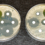 A test of antibacterial resistance.