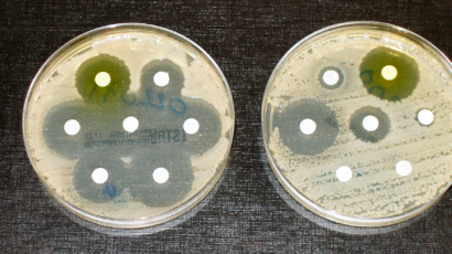 A test of antibacterial resistance.