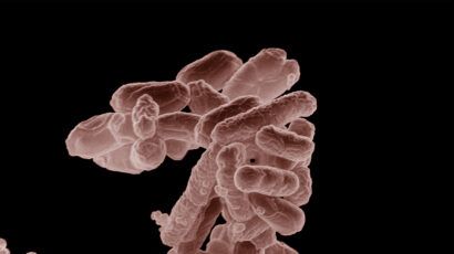 E. coli bacteria