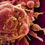 SARS virus particle closeup