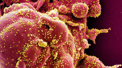 SARS virus particle closeup