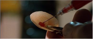 blood sachet